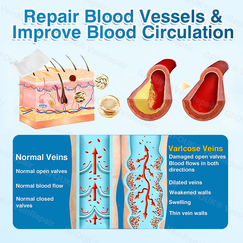 🏆🏃GFOUK® VeinRepair Microneedle Patch Roll⚡Instant Relief, Long-Term Results