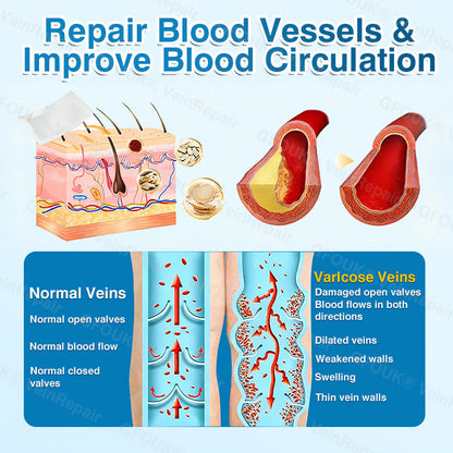🏆🏃GFOUK® VeinRepair Microneedle Patch Roll⚡Instant Relief, Long-Term Results