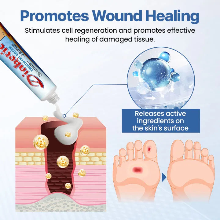 LIMITED TIME 60% OFF🔥AnnieCare® VitaGluco Diabetes Treatment Cream -👨‍⚕️ American Academy of Dermatology (AAD) Approved