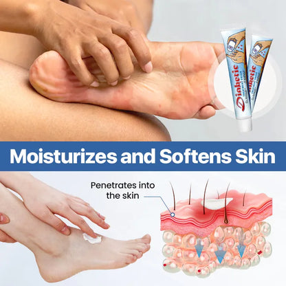 LIMITED TIME 60% OFF🔥AnnieCare® VitaGluco Diabetes Treatment Cream -👨‍⚕️ American Academy of Dermatology (AAD) Approved