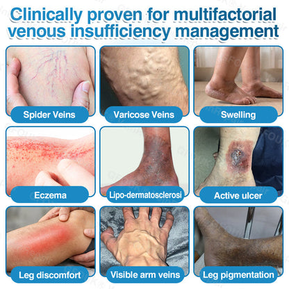 🏆🏃GFOUK® VeinRepair Microneedle Patch Roll⚡Instant Relief, Long-Term Results