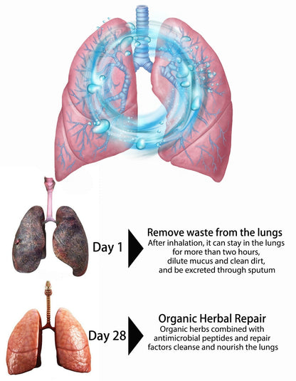 ☘️Official Brand Store✅OnNature Organic Herbal Lung Cleanse & Repair Nasal Spray